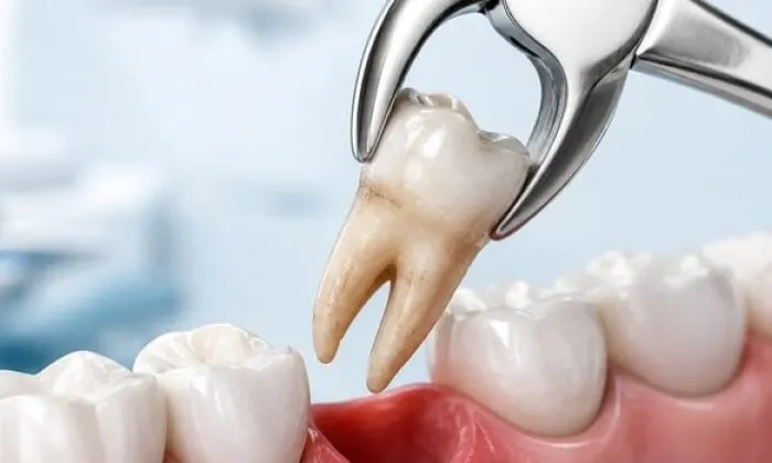 Stomatologiyanın “səhnə arxası” – Çəkilən çürük dişlər hara gedir?
